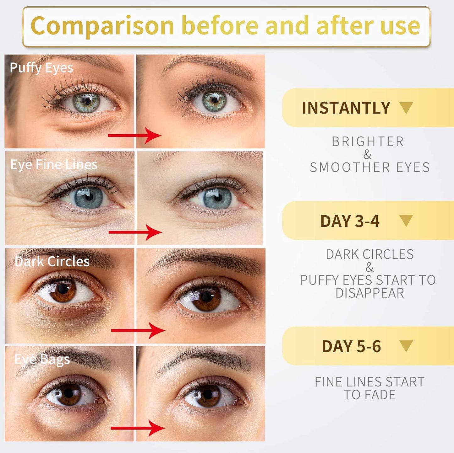 Zermet 1 24K Gold Under Eye Patches - 60 Pack for Puffy Eyes, Dark Circles, Bags & Wrinkles with Collagen & Hyaluronic Acid