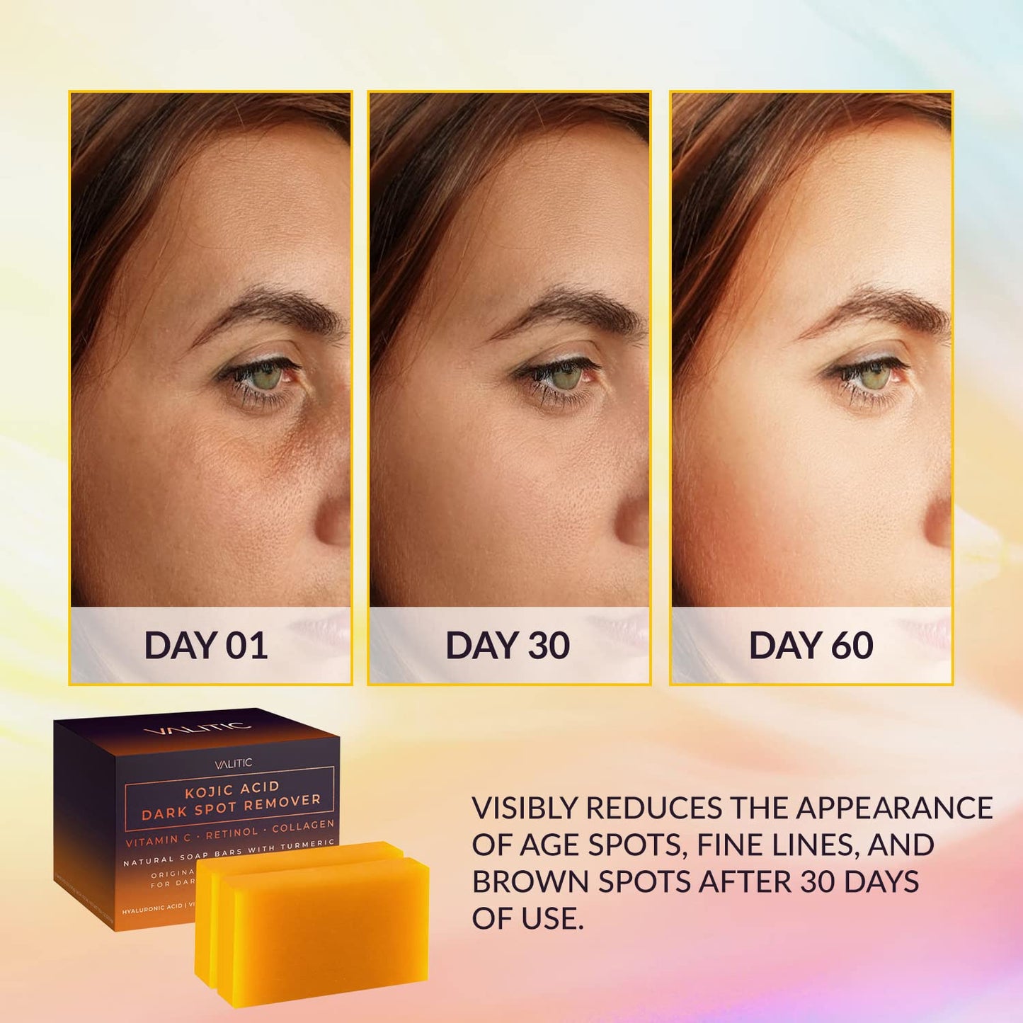 Zermet 1 Zermet 1 Kojic Acid Dark Spot Remover Soap Bars with Vitamin C, Retinol, Collagen, Turmeric - Original Japanese Complex Infused with Hyaluronic Acid, Vitamin E, Shea Butter, Castile Olive Oil (2 Pack)