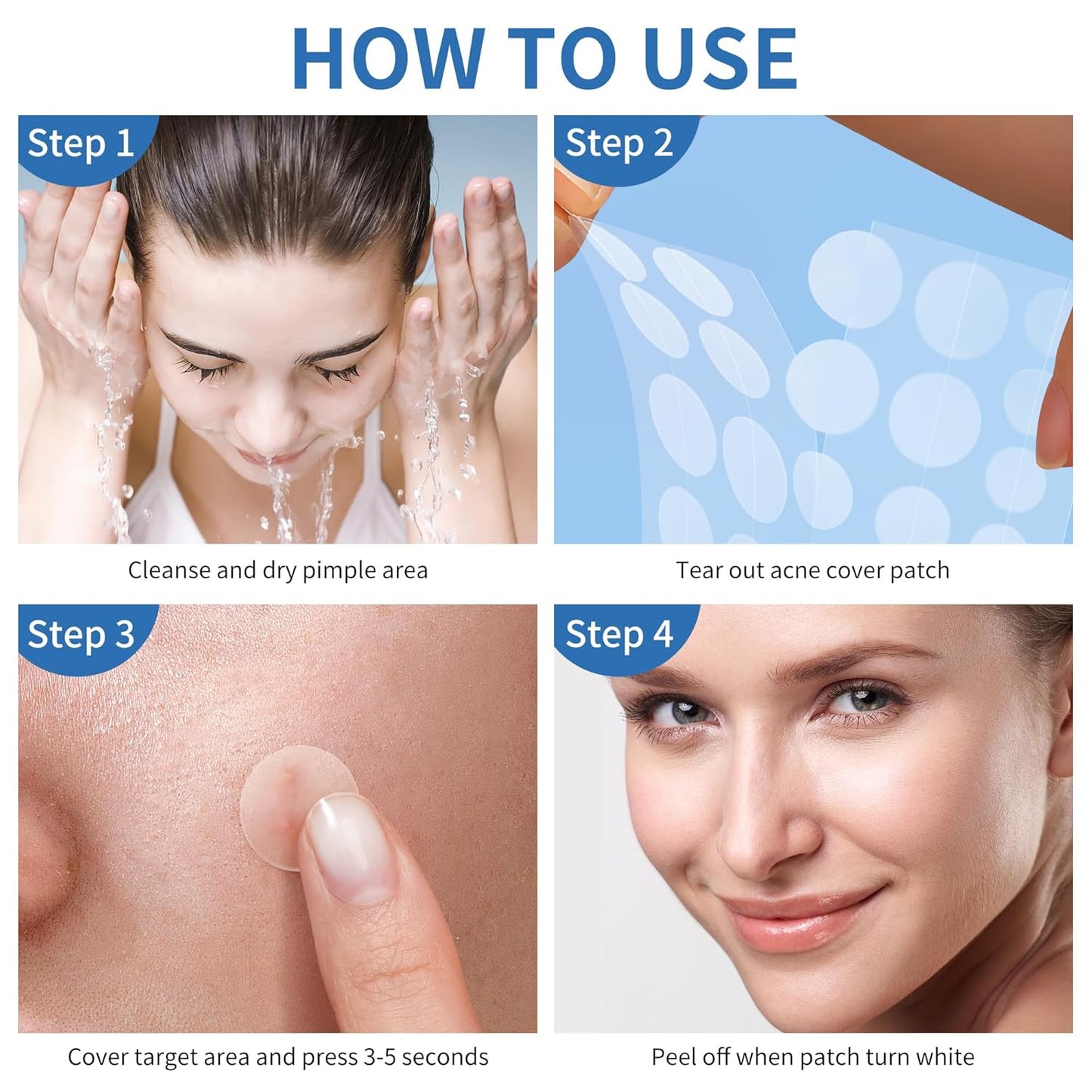 Zermet 1 Pimple Patches for Face, 4 Size 300 Counts Acne Patches, Hydrocolloid Patches for Covering Zits and Blemishes, Spot Stickers with Salicylic Acid, Tea Tree Oil & Calendula Oil