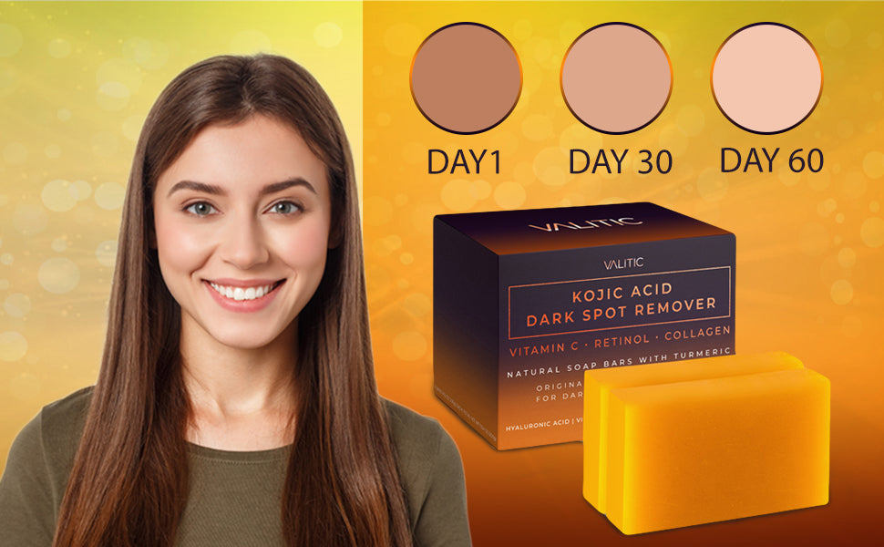 Zermet 1 Zermet 1 Kojic Acid Dark Spot Remover Soap Bars with Vitamin C, Retinol, Collagen, Turmeric - Original Japanese Complex Infused with Hyaluronic Acid, Vitamin E, Shea Butter, Castile Olive Oil (2 Pack)