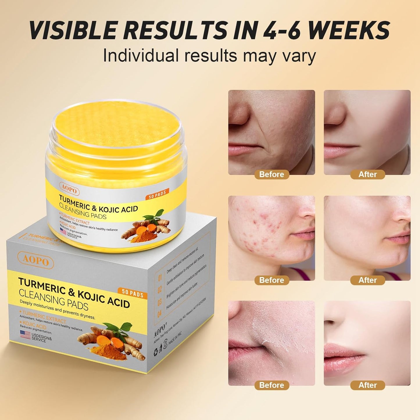 Zermet 1 Kojic Acid and Turmeric Cleansing Pads, 50 Pcs, for Face Cleansing and Exfoliation