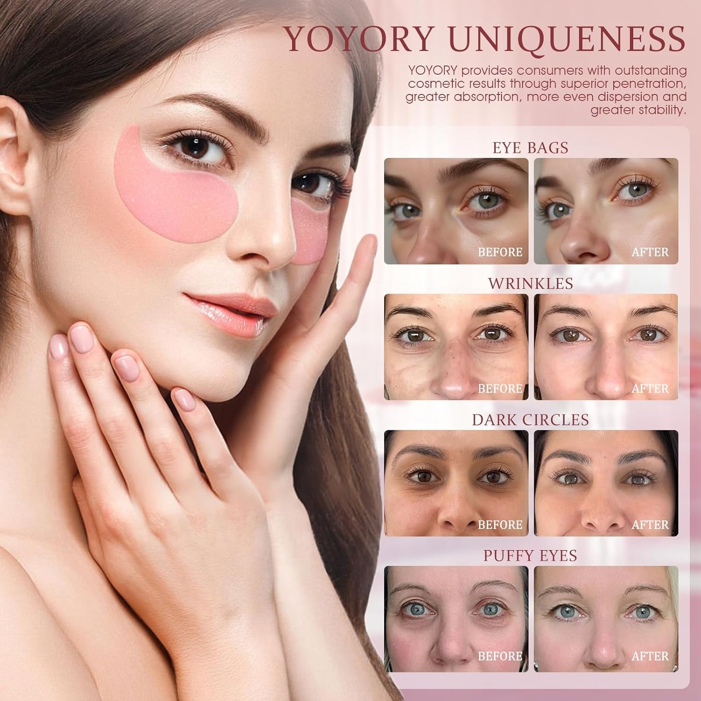 Zermet 1 Under Eye Patches Masks - for Dark Circles, Puffiness, Eye bags,and Fine Lines Smoothing Skin Care Treatment with Collagen and Hyaluronic Acid for Women and Men, (60 Pcs) Pink