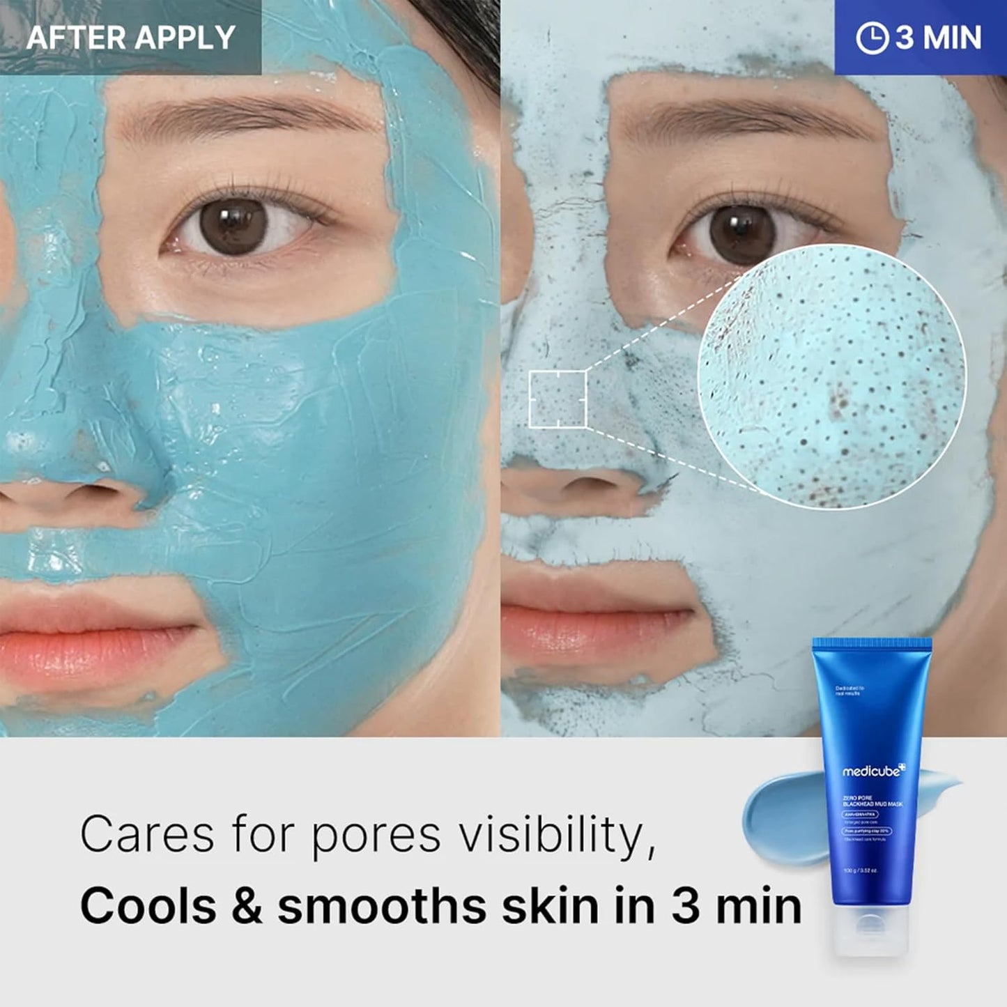Zermet 1 Medicube Zero Pore Blackhead Mud Facial Mask - Skin Cooling & Pore Tightening - 3 Minute Quick Dry Formula with AHA, BHA, PHA, and Pore-Purifying Clay - Korean Mud Mask 3.52 oz