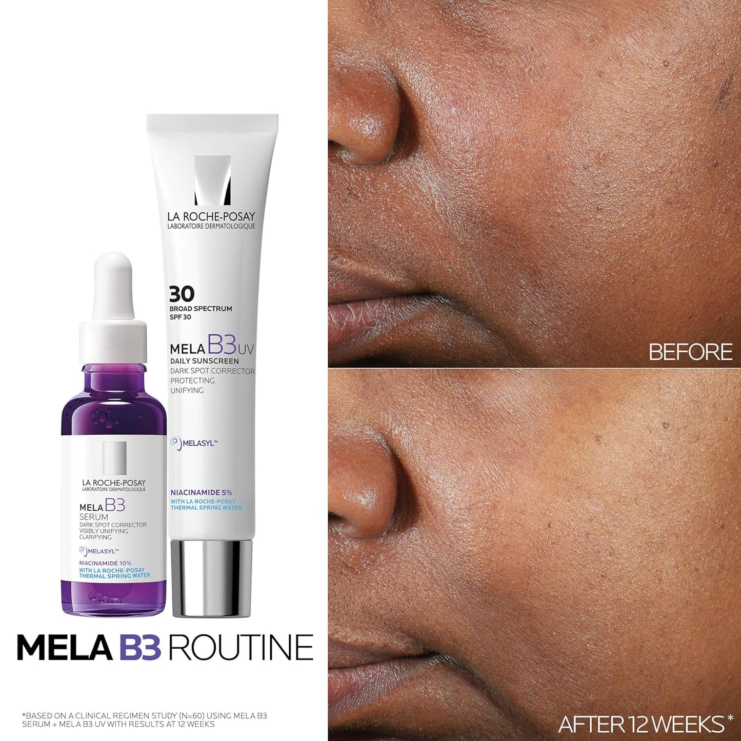 Zermet 1 La Roche-Posay Mela B3 UV Daily Sunscreen, Face Moisturizer With SPF 30 + Anti-Aging Melasyl + 5% Niacinamide, Helps Correct & Protect From Sun Damage, Face Sunscreen With No White Cast, 40ML