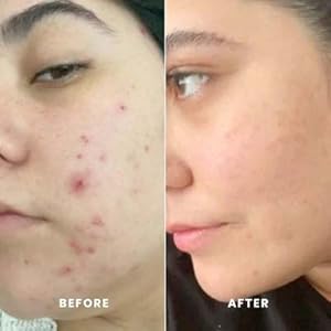 Zermet 1 Gleamin Vitamin C Clay Mask for Dark Spots, Turmeric Clay Face Mask Skin Care, Deeply Cleanses & Refines Pores, Brightens Uneven Tone and Helps Improve Post-Blemish Scarring & Texture, Up to 20 Uses