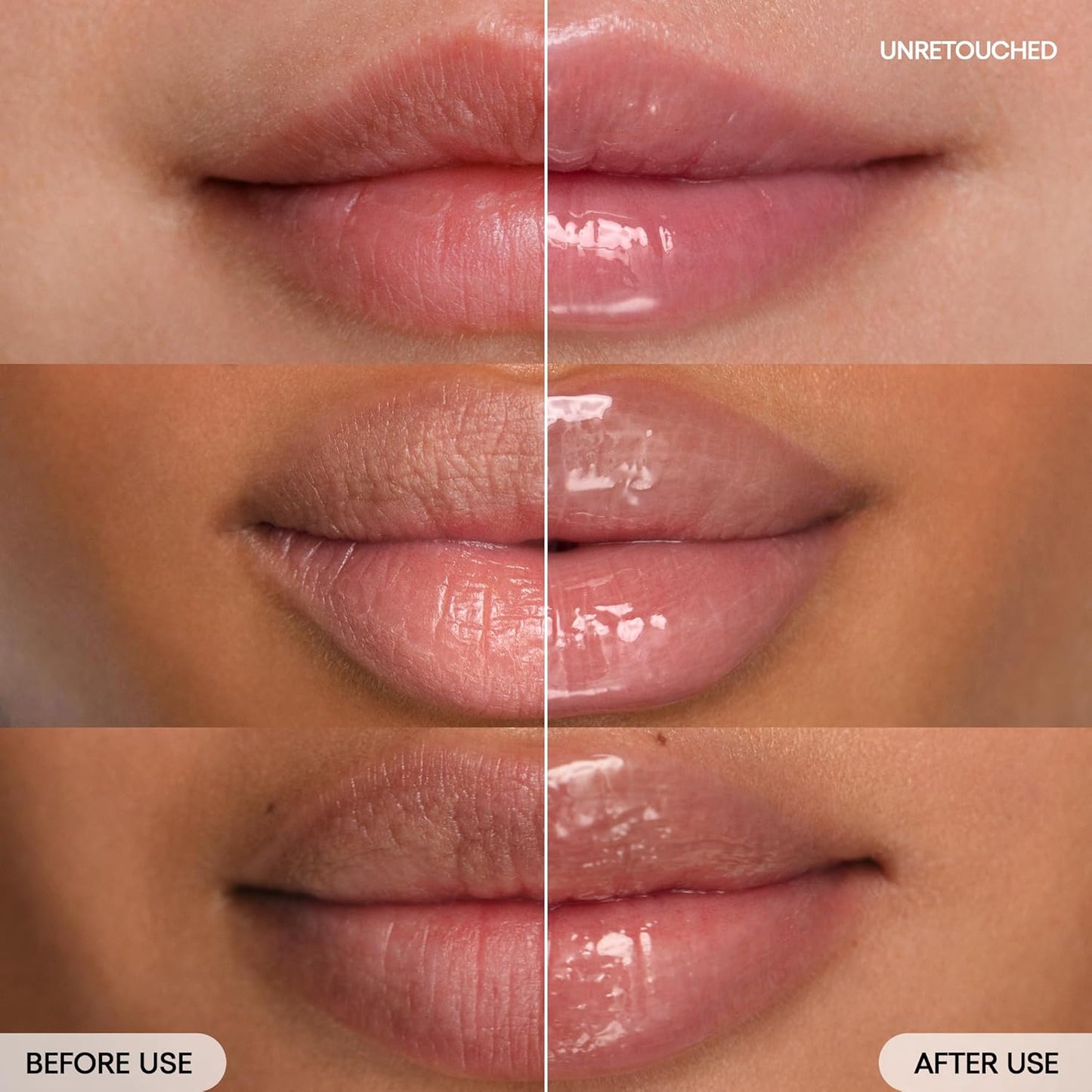 Zermet 1 Zermet 1  Lip Sleeping Mask: Nourish, Hydrate, Vitamin C, Murumuru & Shea Butter, Antioxidants, Flaky, Dry Lips