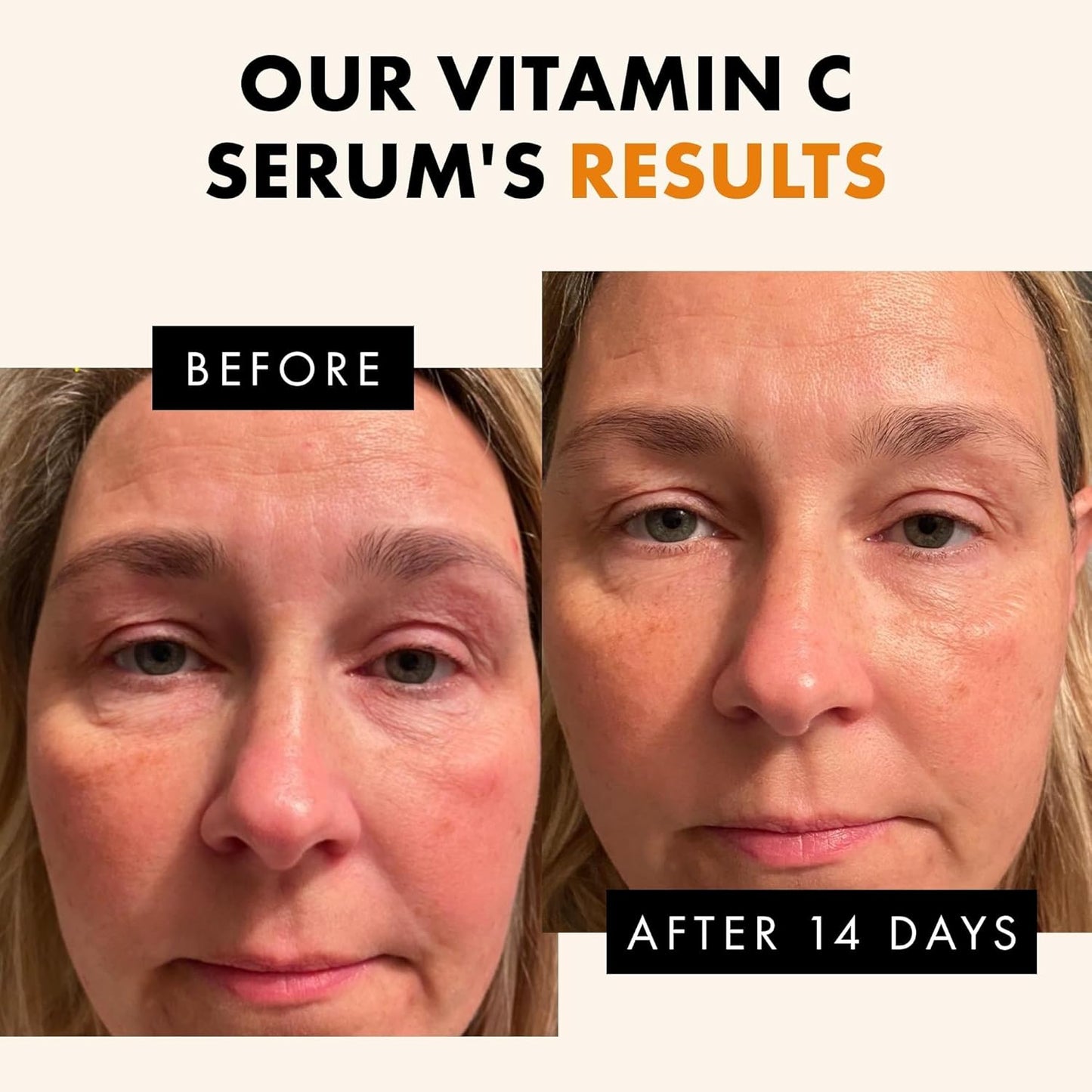 Zermet 1 Eclat Skincare Vitamin C Face Serum - Skin Care for Dark Spots, Vitamin C Serum with Hyaluronic Acid, Ferulic Acid, & Vit E - Anti Aging and Skin Brightening, Pure Vit C Facial Care - 30 ml