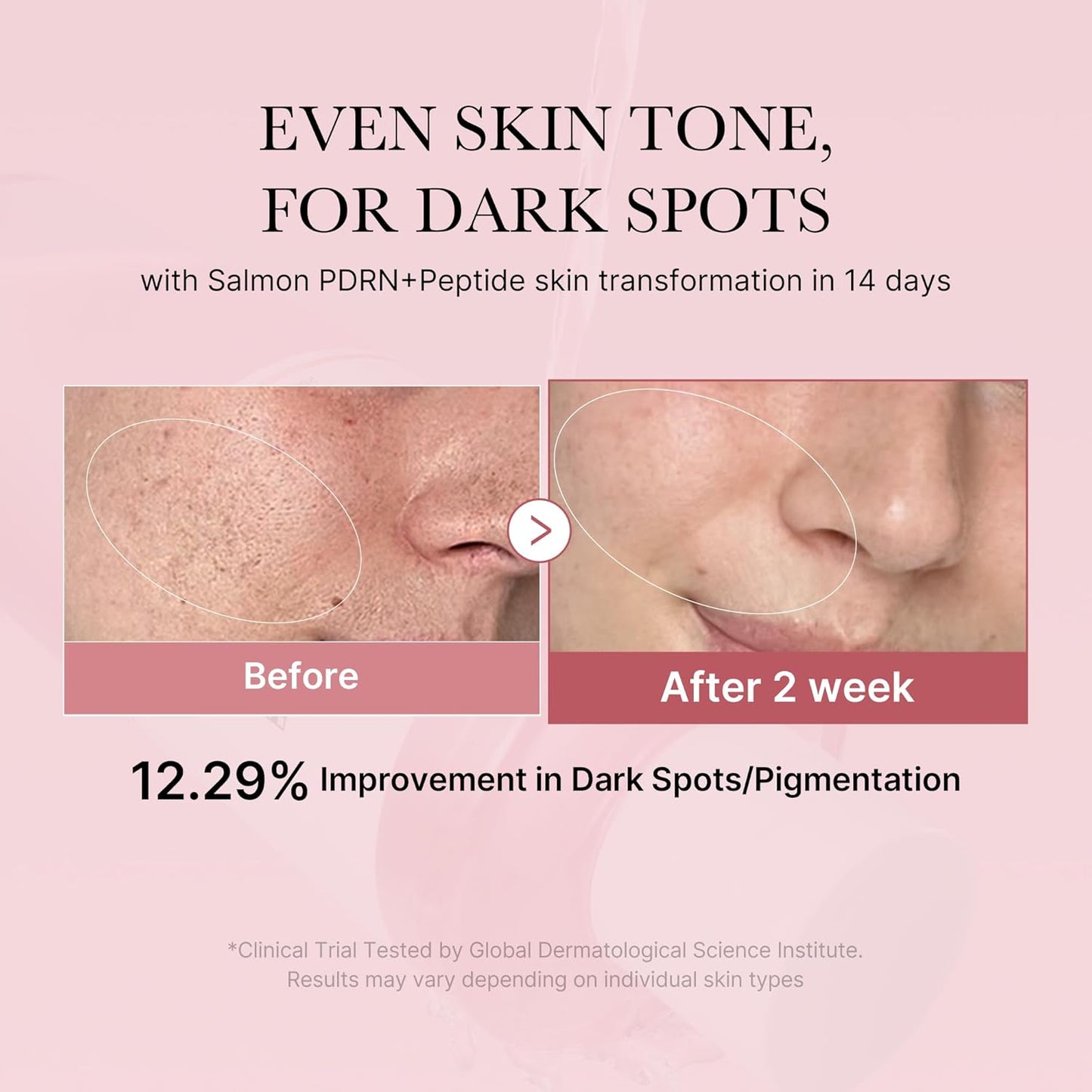 Zermet 1 medicube Salmon DNA Zermet 1  Pink CICA Soothing Toner I Pink Glow Toner for Skin Boosting, Soothing and Calming, Uneven Skin Tone, Peptide & Niacinamide, Korean Skin Care (250ml / 8.45 fl. oz.)