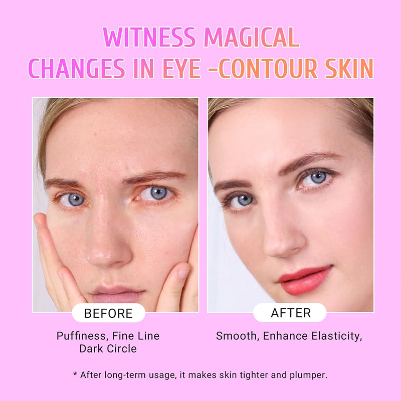 Zermet 1 Under Eye Patches Gold and Hyaluronic Acid for puffy eyes,Rose Eye Masks for Dark Circles and Puffiness skin care Smooth Wrinkles products 30 Pairs