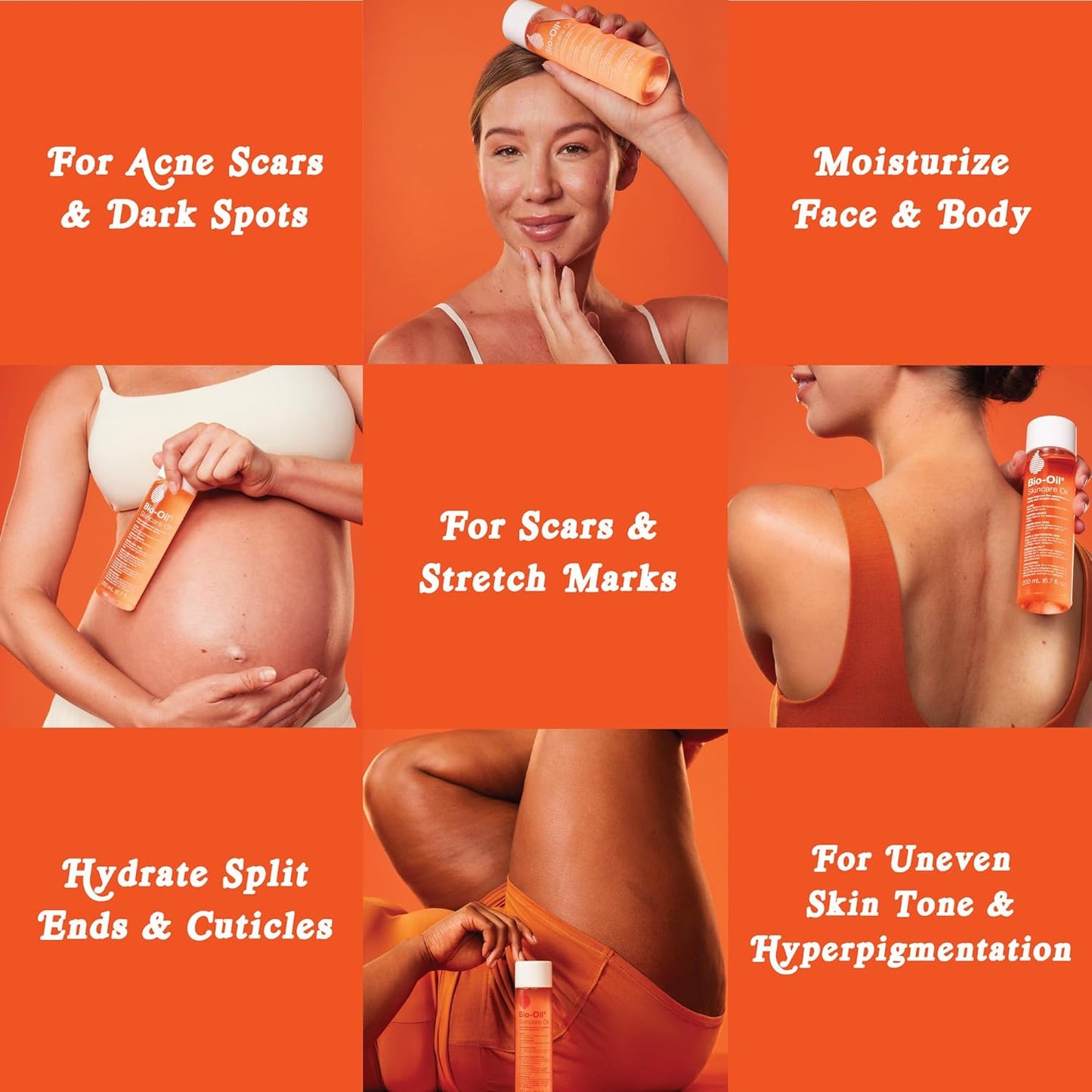 Zermet 1 Bio-Oil Skincare Body Oil Serum, Face and Body Moisturizer with Vitamin E & A, for Scars, Stretch Marks, Sensitive Skin, All Skin Types, Dermatologist Recommended, Non-Comedogenic, 6.7 Oz