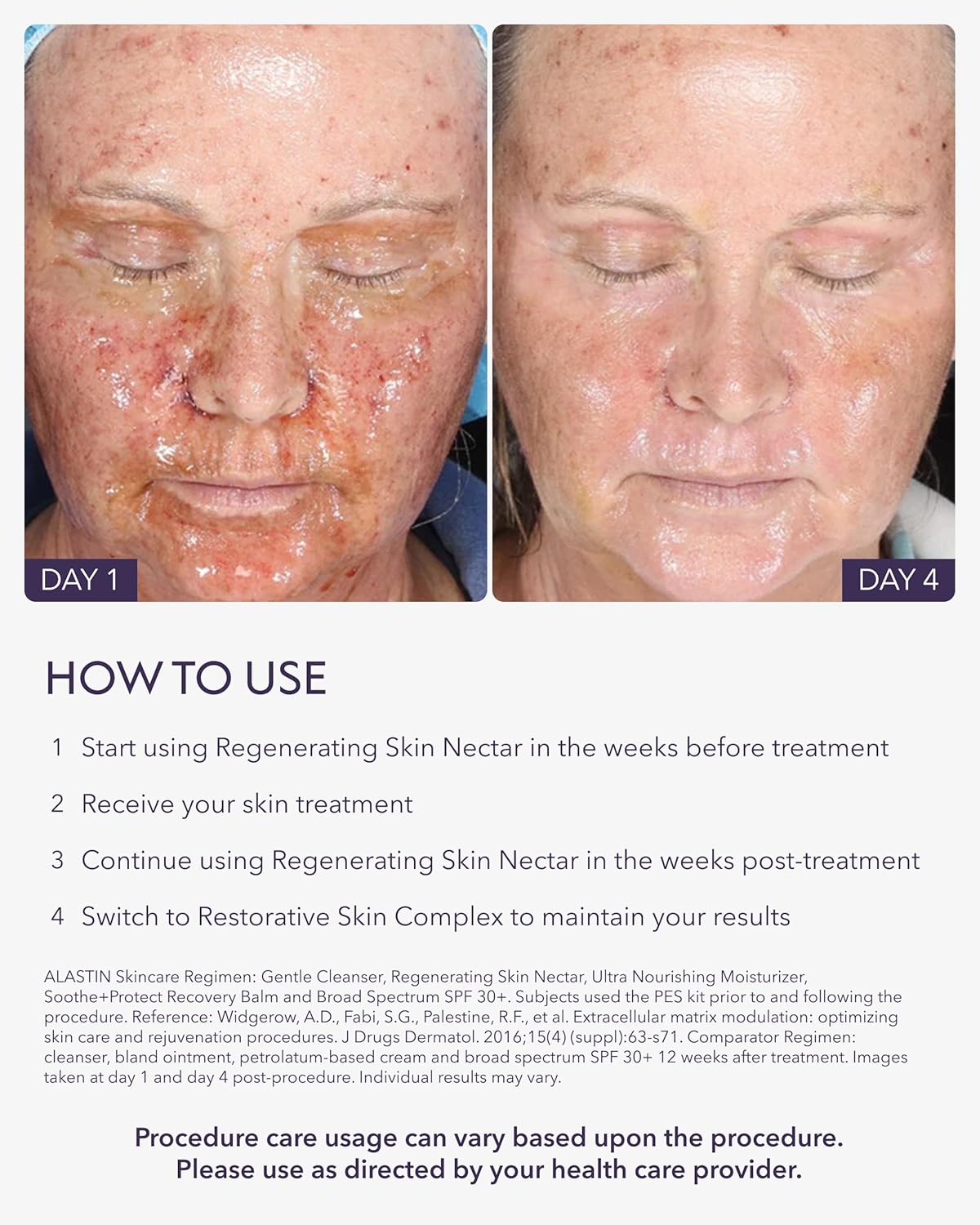 Zermet 1 Zermet 1  Skincare Regenerating Skin Nectar Face Moisturizer (1 oz) | Hydrating Serum Strengthens & Soothes Post-Procedure Skin | Safe for Sensitive Skin