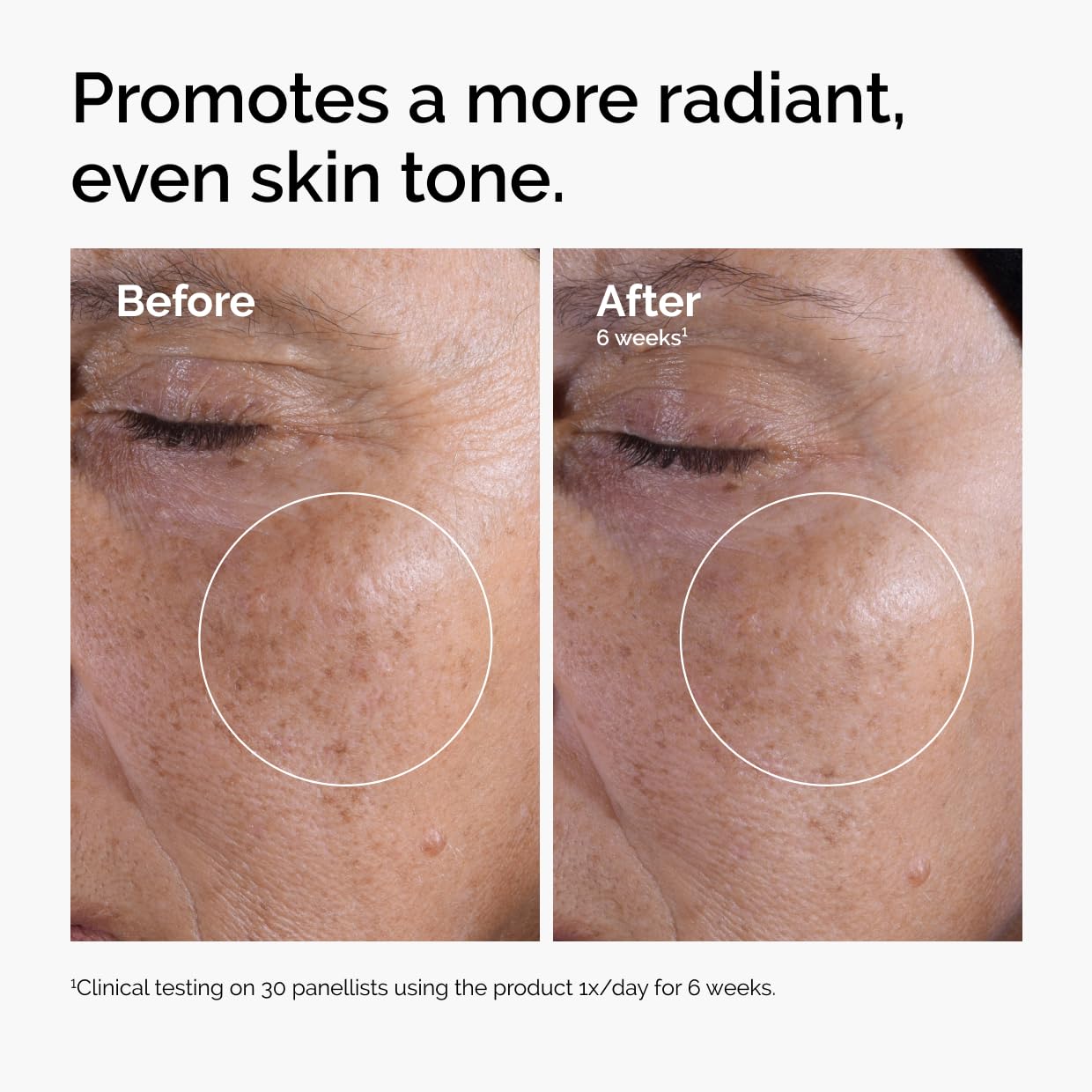 Zermet 1 The Ordinary Glycolic Acid 7% Exfoliating Toner, Brightening and Smoothing Daily Toner for More Even-Looking Skin Tone
