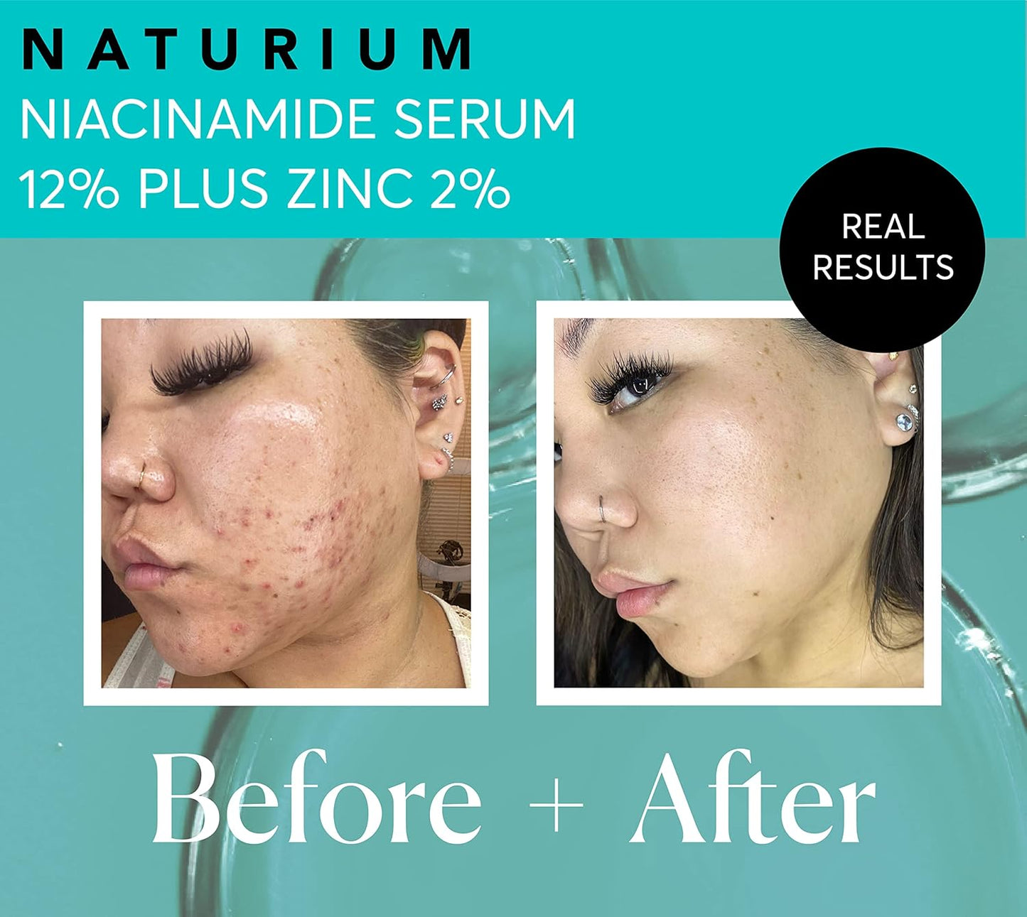 Zermet 1 Zermet 1  Niacinamide Face Serum 12% Plus Zinc 2%, Anti-Aging, Pore Minimizer & Dark Spot Corrector with Hyaluronic Acid & Vitamin E, Vegan & Cruelty-Free, 1 oz
