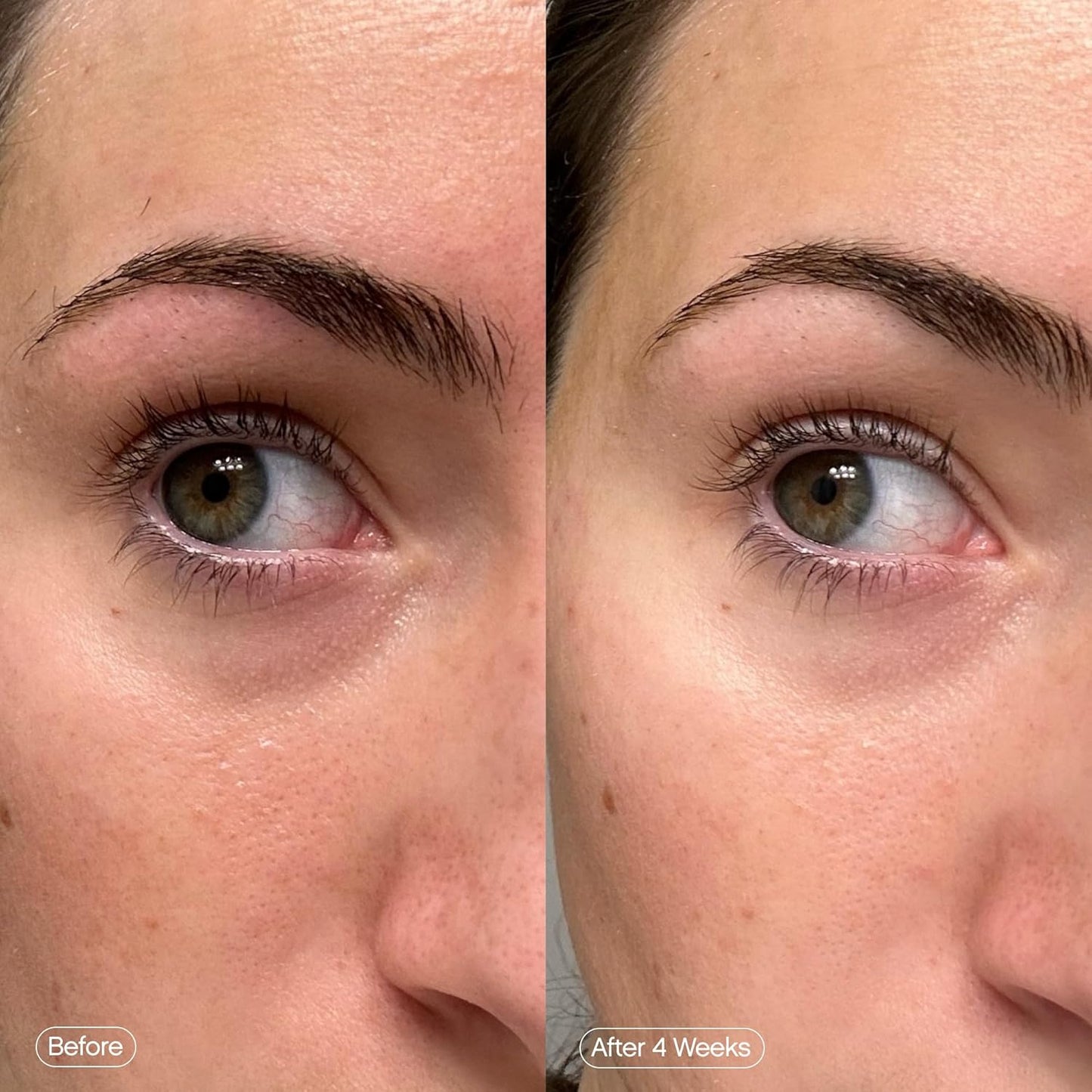 Zermet 1 Topicals Faded Brightening Under Eye Masks | Revitalizing Patches to Depuff, Hydrate, and Illuminate | Diminishes Dark Circles and Fine Lines | Made with Kojic Acid, Caffeine & Niacinamide