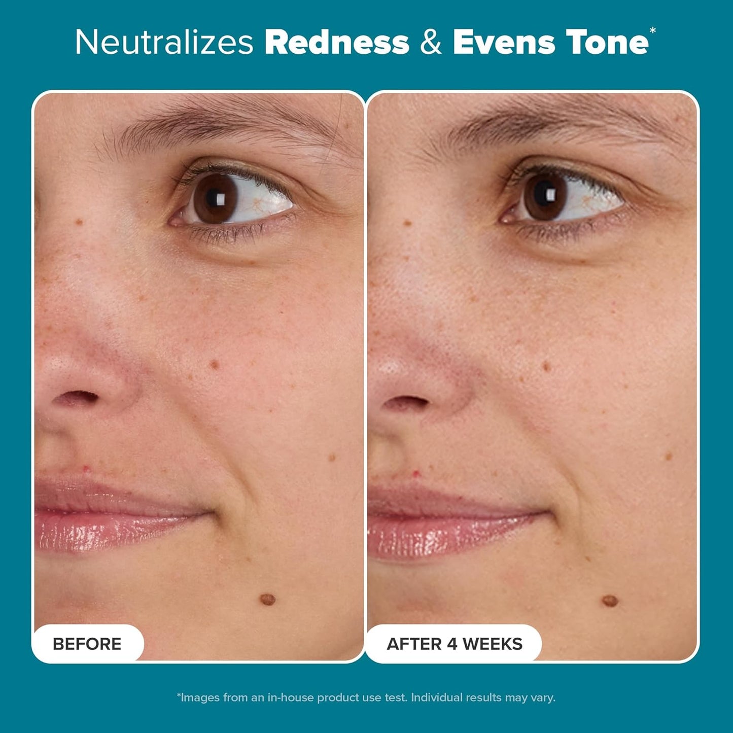 Zermet 1 Paula's Choice SKIN BALANCING Pore-Reducing Face Toner with Niacinamide, for Oily Skin & Combination, Minimizes Large Pores, Controls Oil & Shine, Hydrates & Replenishes, Fragrance-Free