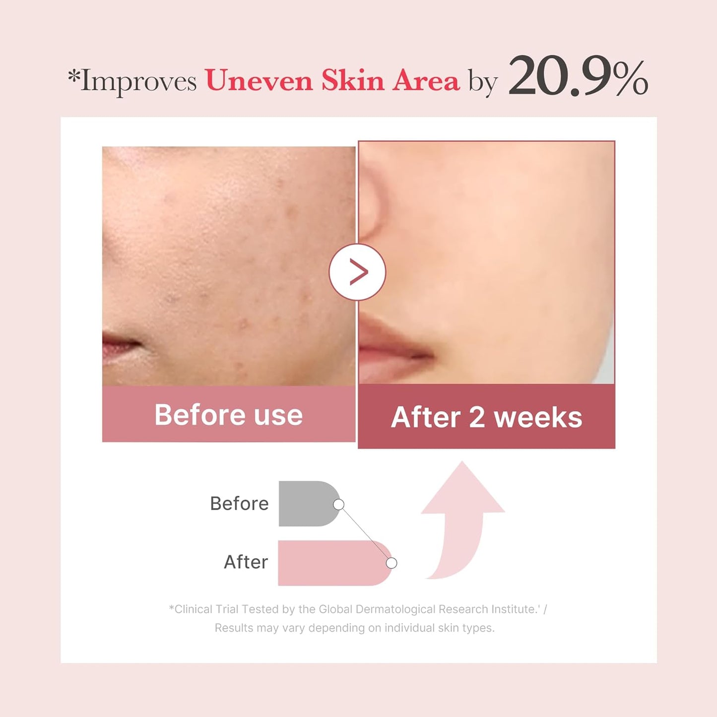 Zermet 1 medicube Zermet 1  Pink Collagen Exosome Shot Serum 7,500 PPM | Liquid Skin Booster | Exosome, Salmon DNA Zermet 1 , Spicules | Uneven Skin Tone, Pore Care, Skin Texture | Korean Skin Care 1.01 fl.oz