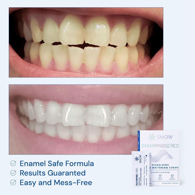 SNOW Diamond Teeth Whitening Strips | Gentle & Enamel Safe White Strips for Teeth Whitening | at Home Dental Hygiene & Tooth Care for a White Smile