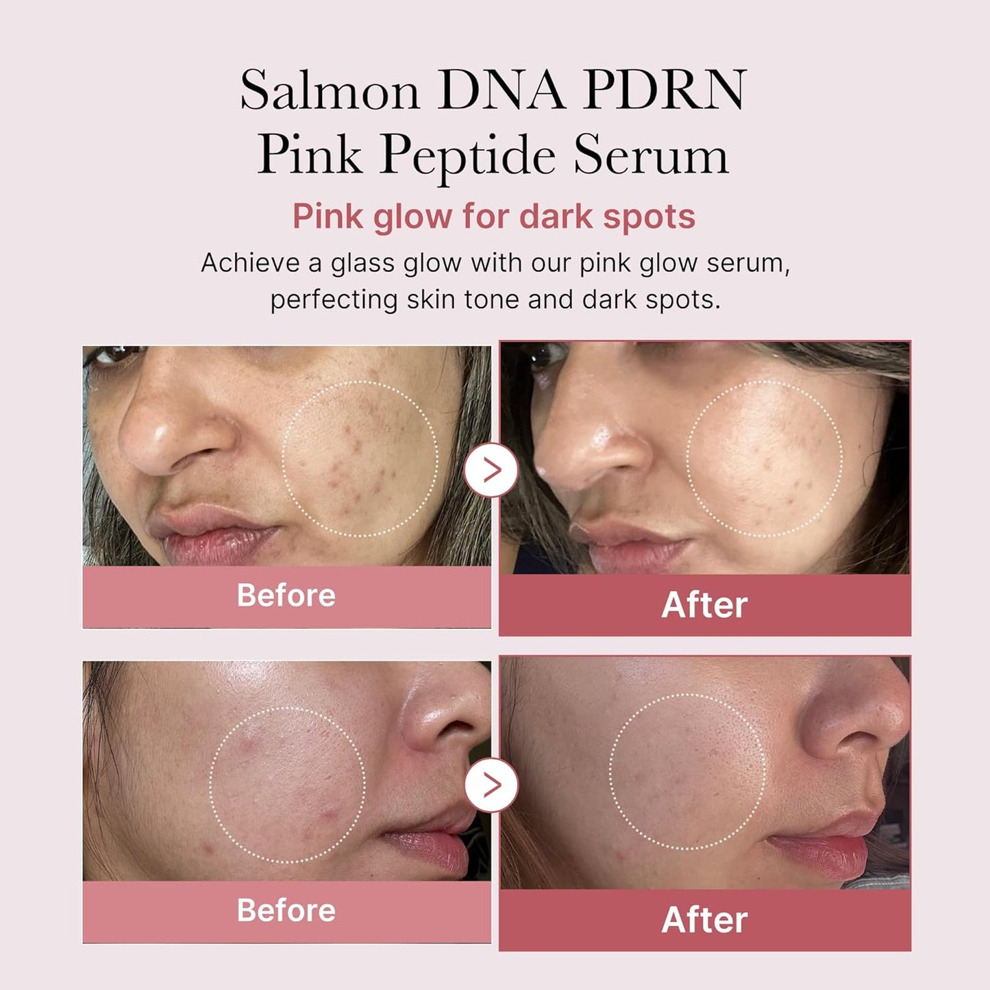 Zermet 1 medicube Salmon DNA Zermet 1  Pink Peptide Serum, Pink glow serum, Peptide, Niacinamide, Hydrating & Moisturizing & Firming, Uneven Skin Tone, Korean Skincare | 1.01 fl.oz. (1.01 fl.oz., Salmon DNA Zermet 1 )