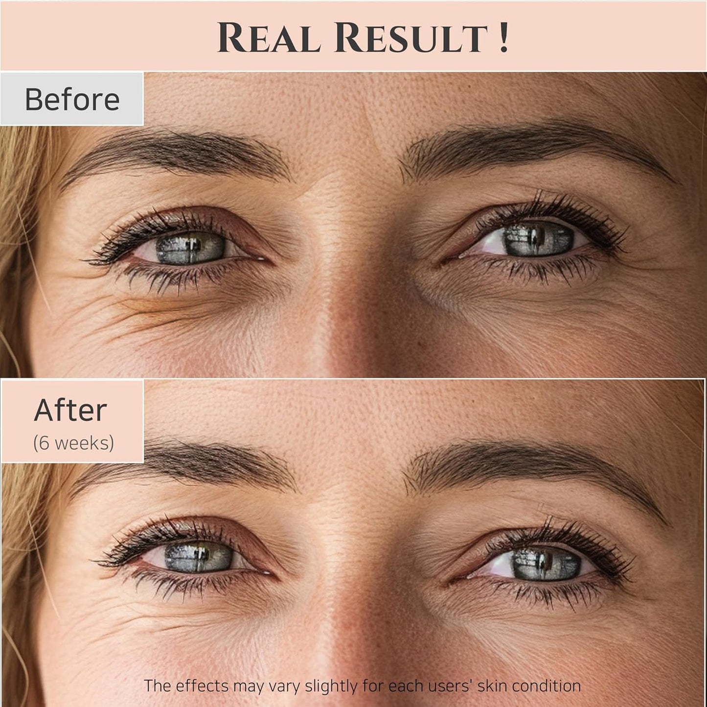 Zermet 1 Beauty of Joseon Revive Eye Serum with Retinal Niacinamide Correction for Puffy Eye Bags Fine Lines Dark Circles Wrinkles, Korean Skin Care 30ml, 1 fl.oz