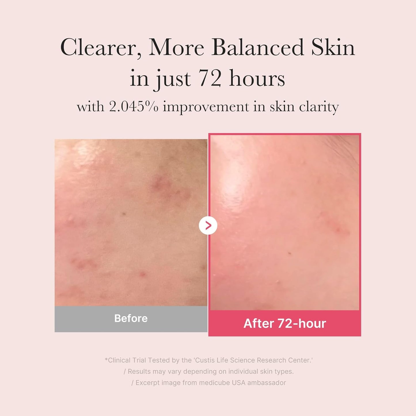 Zermet 1 medicube TXA+Niacinamide 15% Glow Facial Serum for After Spot Care | All-in-One Daily Korean Skincare | Uneven Skin Tone, Texture, and Hydration Care | High-Potency Tranexamic Acid 5% | 1.01 fl.oz
