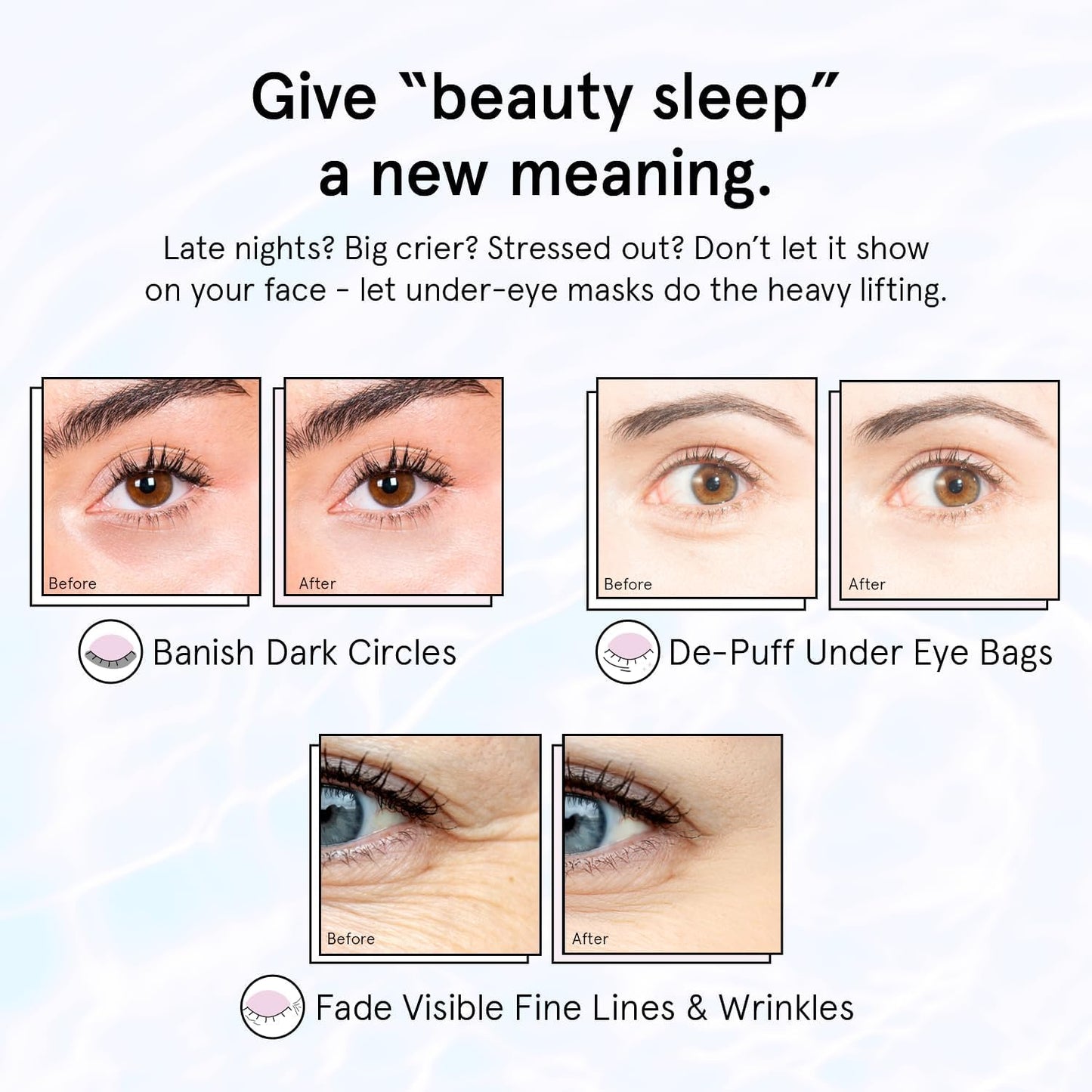 Zermet 1 grace & stella Retinol Under Eye Patches for Puffy Eyes and Dark Circles - Restoring Gel Under Eye Masks with Hyaluronic Acid - Vegan Cruelty-Free Skincare, Birthday Gifts for Women (Purple, 24 Pairs)