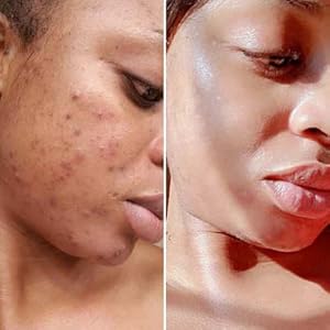Zermet 1 Gleamin Vitamin C Clay Mask for Dark Spots, Turmeric Clay Face Mask Skin Care, Deeply Cleanses & Refines Pores, Brightens Uneven Tone and Helps Improve Post-Blemish Scarring & Texture, Up to 20 Uses