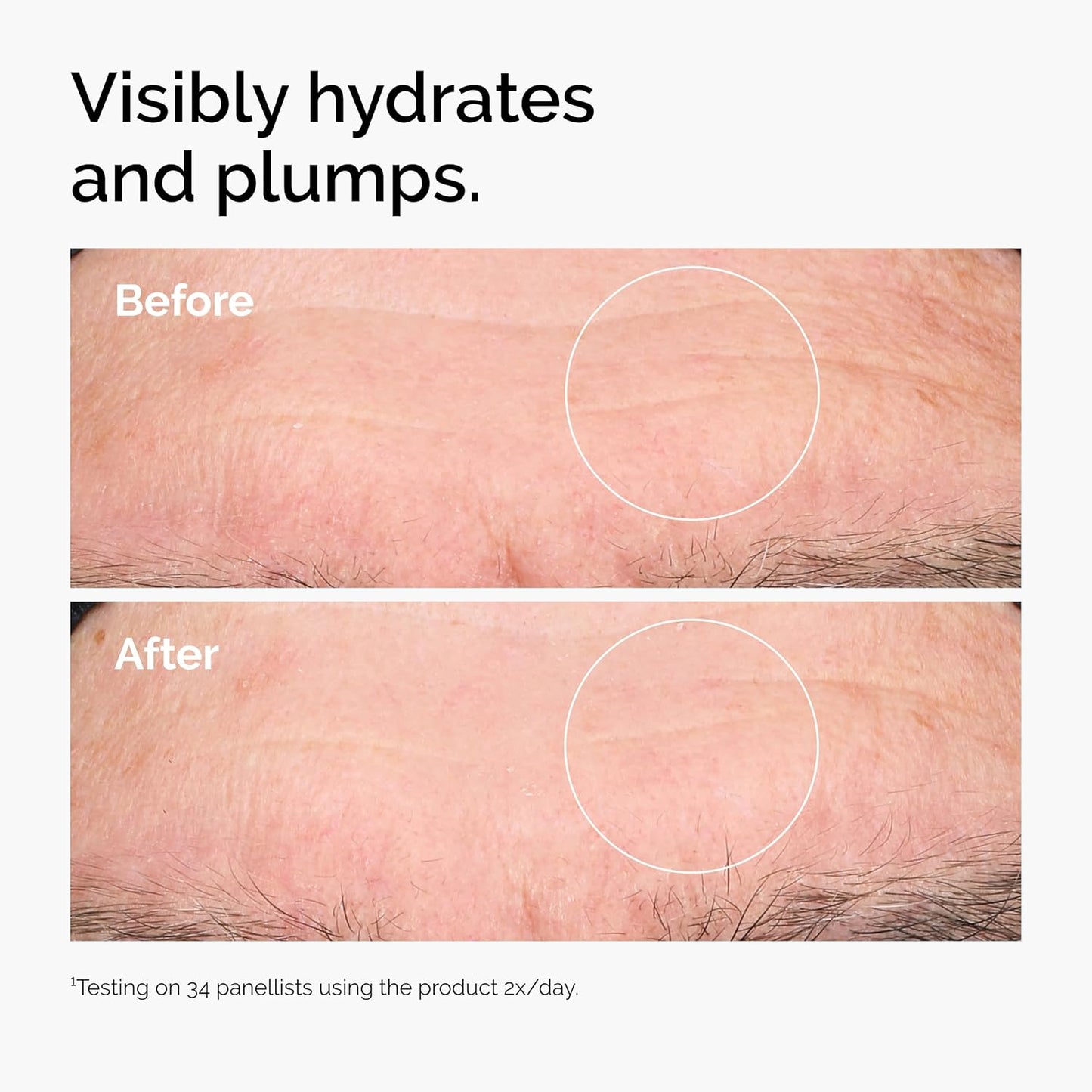 Zermet 1 The Ordinary Hyaluronic Acid 2% + B5 (with Ceramides), Multi-Depth Hydration Serum for Plumper, Smoother Skin